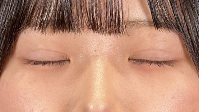 Postoperative Condition Part 1