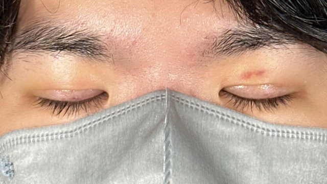 Postoperative Condition Part 1