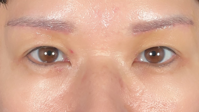 Postoperative Condition Part 1