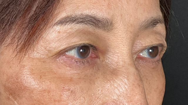 Postoperative Condition Part 1