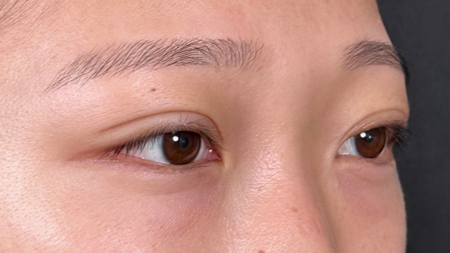 Postoperative Condition Part 1