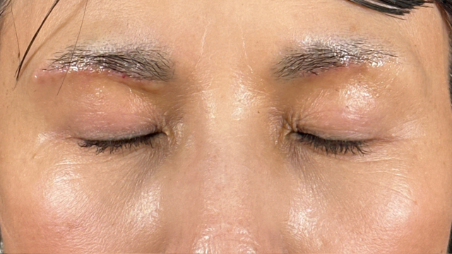 Postoperative Condition Part 1