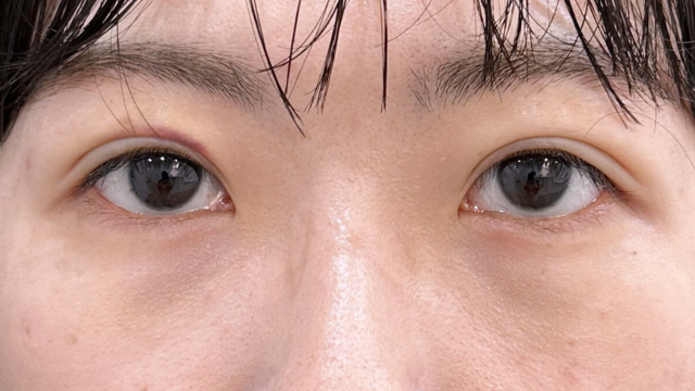 Postoperative Condition Part 1