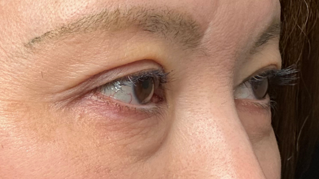 Postoperative Condition Part 1