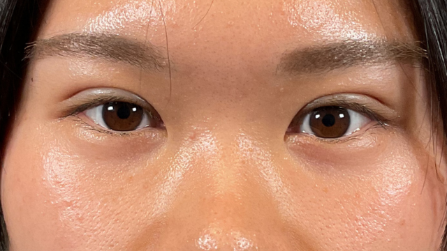 Postoperative Condition Part 1