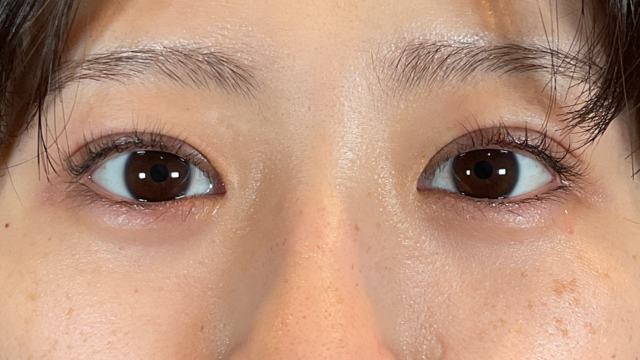 Postoperative Condition Part 1