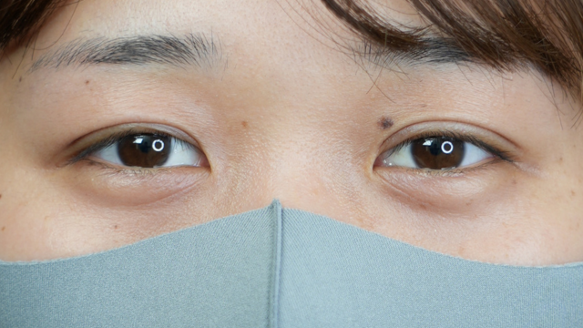 Postoperative Condition Part 1