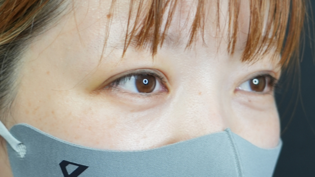 Postoperative Condition Part 1