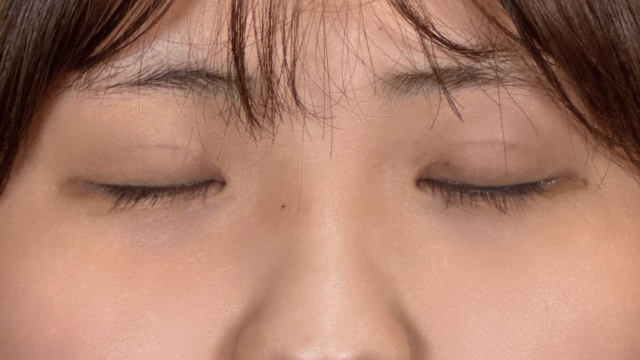 Postoperative Condition Part 1