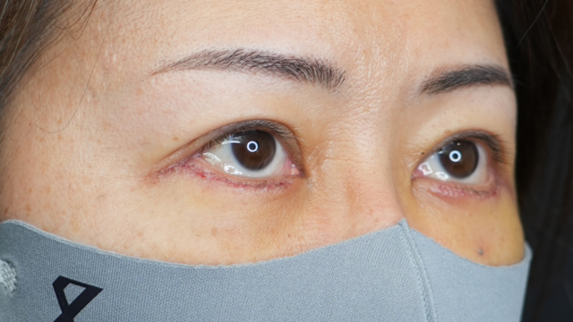 Postoperative Condition Part 1