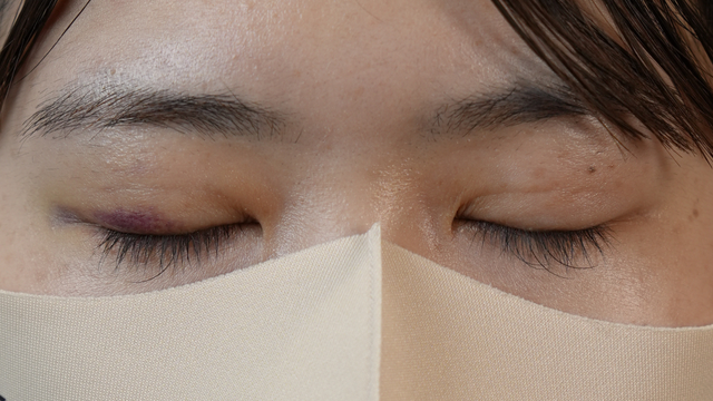 Postoperative Condition Part 1