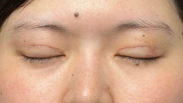 Postoperative Condition Part 1