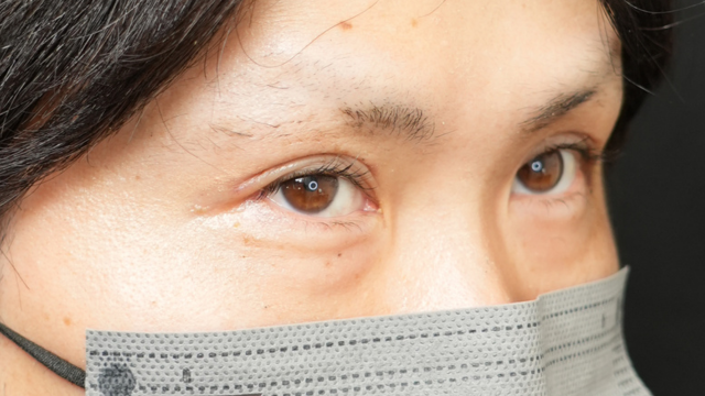 Postoperative Condition Part 1