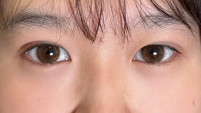 Postoperative Condition Part 1