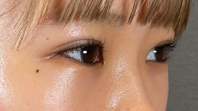 Postoperative Condition Part 1