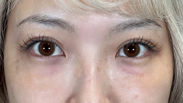 Postoperative Condition Part 1