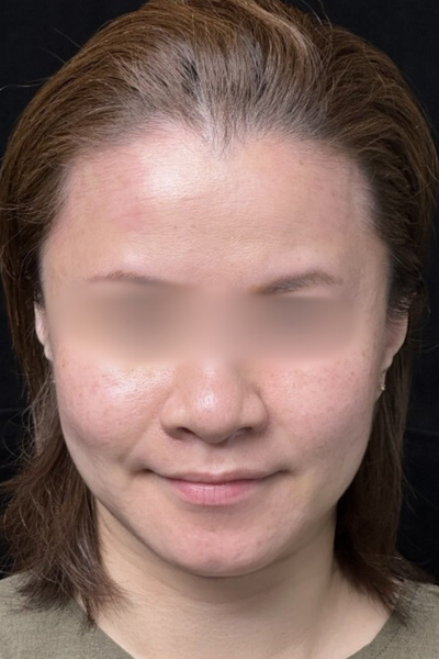 手術前の状態 その1