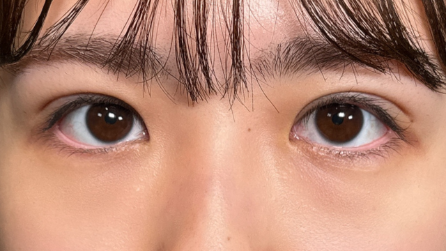 Postoperative Condition Part 1