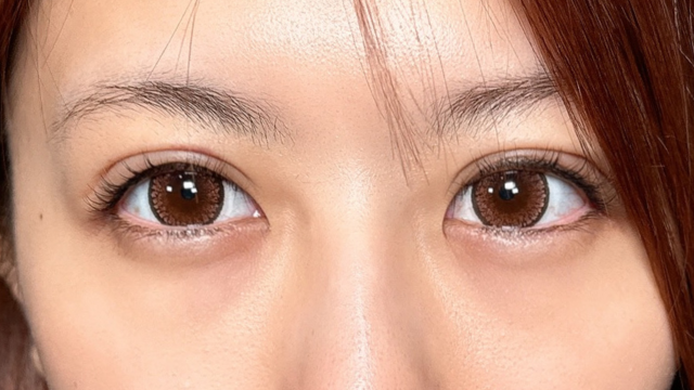 Postoperative Condition Part 1