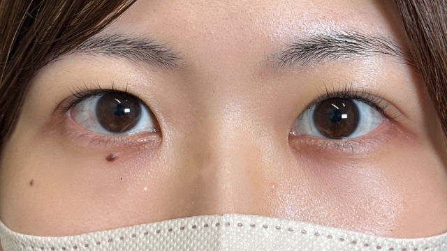 Postoperative Condition Part 1