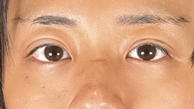 Postoperative Condition Part 1