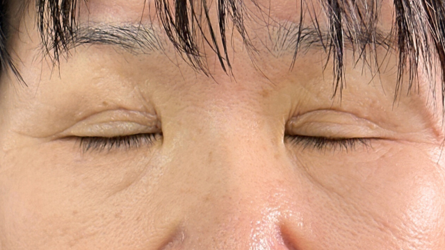 Postoperative Condition Part 1