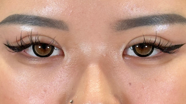 Postoperative Condition Part 1