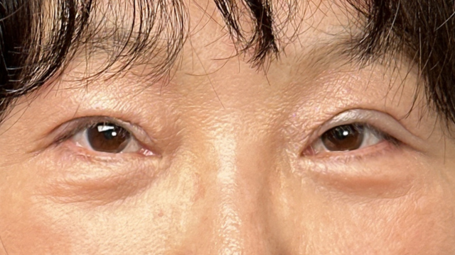 Postoperative Condition Part 1