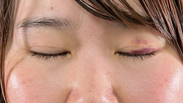 Postoperative Condition Part 1