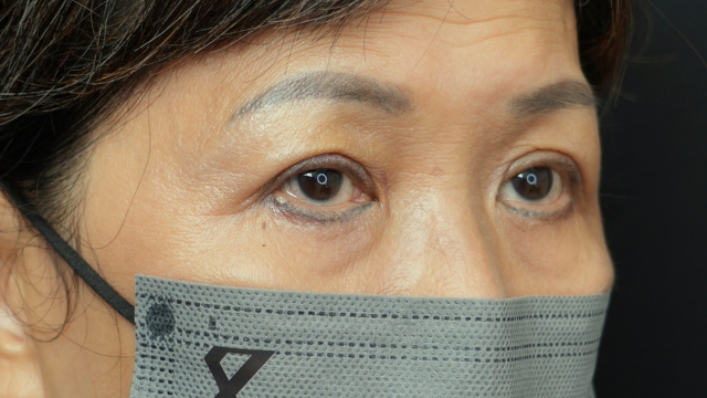 Postoperative Condition Part 1