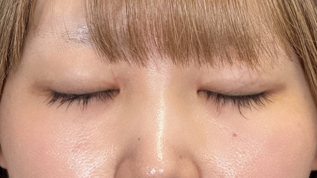 Postoperative Condition Part 1