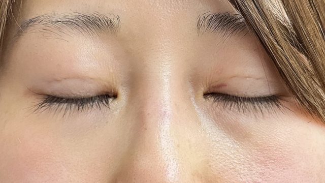 Postoperative Condition Part 1