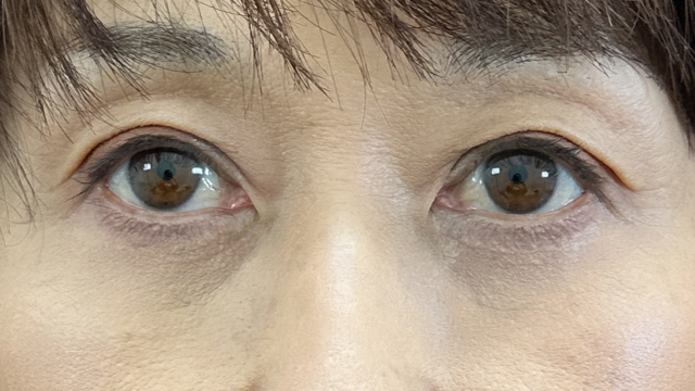 Postoperative Condition Part 1