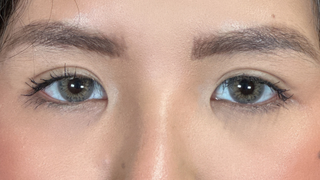 Postoperative Condition Part 1