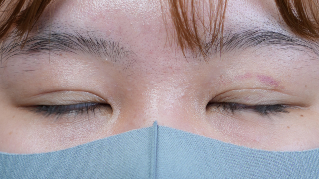 Postoperative Condition Part 1