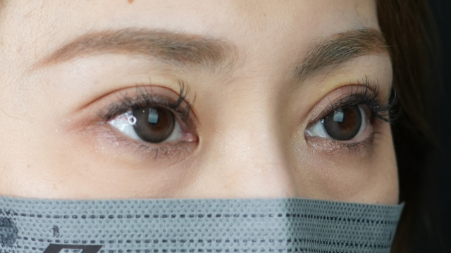 Postoperative Condition Part 1