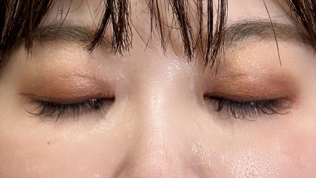 Postoperative Condition Part 1