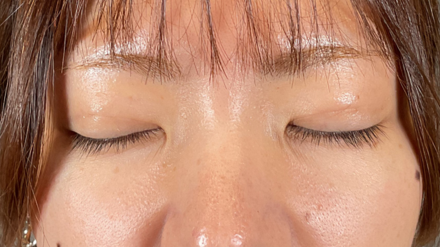 Postoperative Condition Part 1