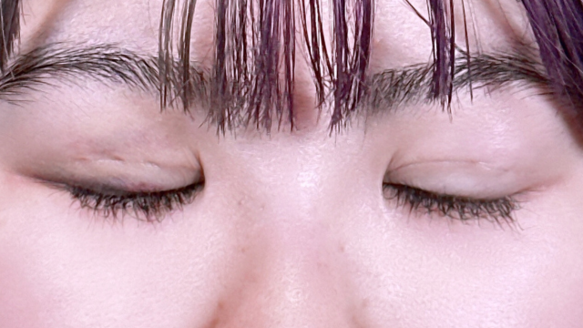 Postoperative Condition Part 1