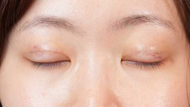 Postoperative Condition Part 1