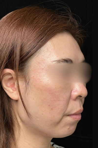 Postoperative Condition Part 1