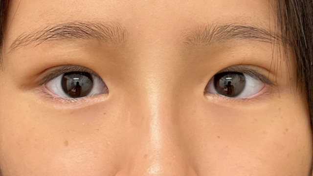 Postoperative Condition Part 1