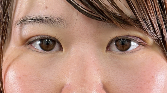 Postoperative Condition Part 1