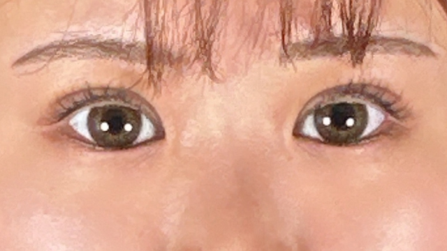 Postoperative Condition Part 1