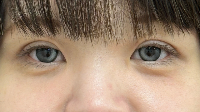 Postoperative Condition Part 1