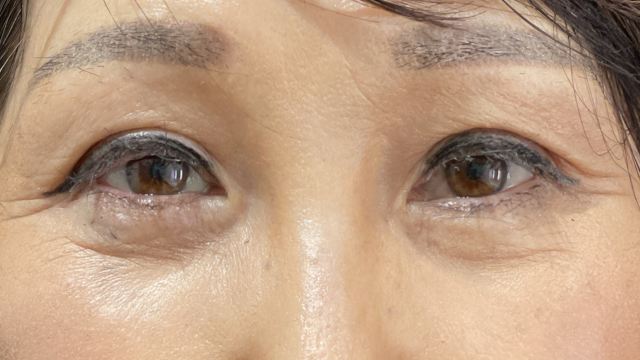 Postoperative Condition Part 1