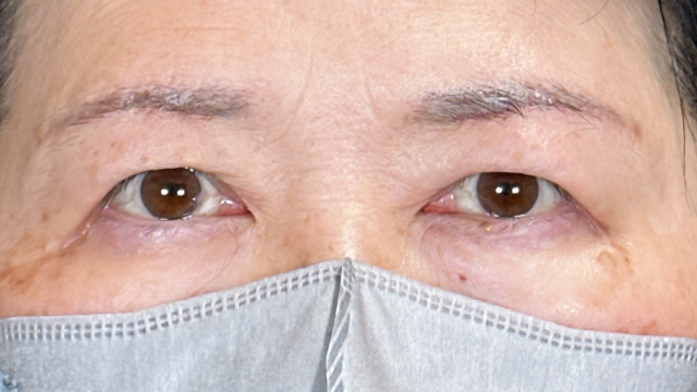 Postoperative Condition Part 1