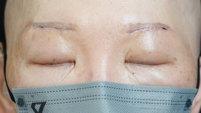 Postoperative Condition Part 1