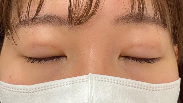 Postoperative Condition Part 1