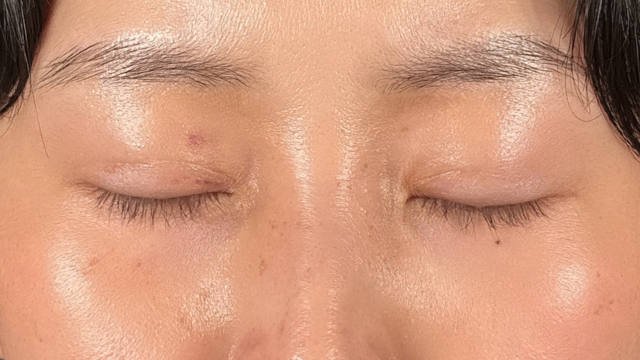 Postoperative Condition Part 1